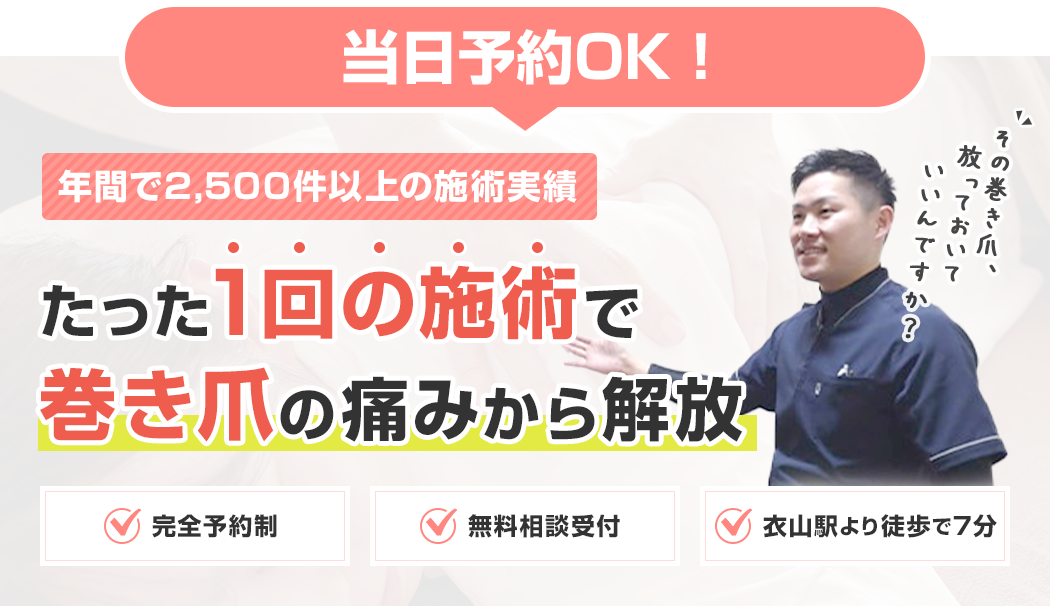 当日予約OK！年間で2,500件以上の施術実績。たった1回の施術で巻き爪の痛みから解放